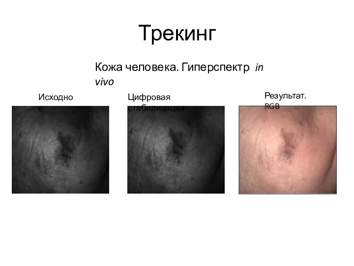 Трекинг Исходное Цифровая стабилизация Результат. RGB Кожа человека. Гиперспектр in vivo