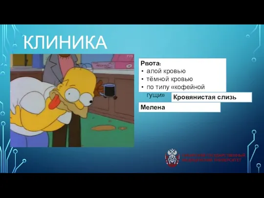 КЛИНИКА Рвота: алой кровью тёмной кровью по типу «кофейной гущи» Кровянистая слизь Мелена