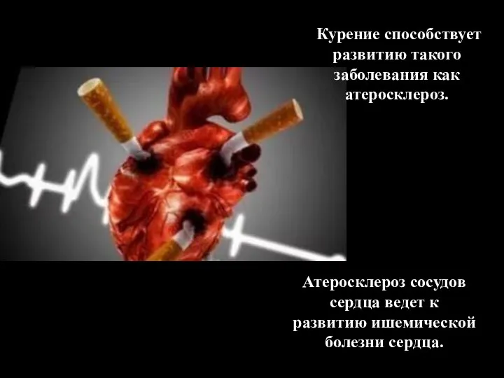 Курение способствует развитию такого заболевания как атеросклероз. Атеросклероз сосудов сердца ведет к развитию ишемической болезни сердца.
