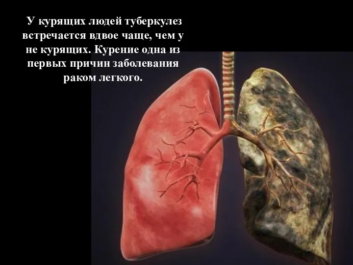 У курящих людей туберкулез встречается вдвое чаще, чем у не курящих. Курение