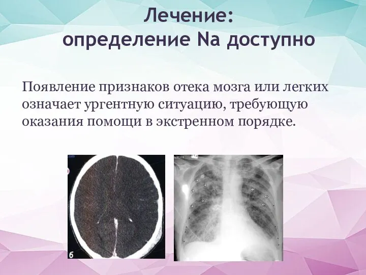 Появление признаков отека мозга или легких означает ургентную ситуацию, требующую оказания помощи