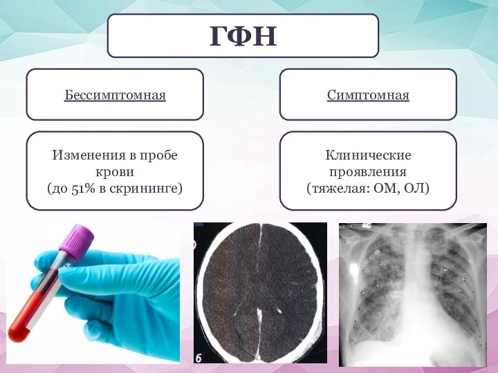 ГФН Бессимптомная Симптомная Изменения в пробе крови (до 51% в скрининге) Клинические проявления (тяжелая: ОМ, ОЛ)