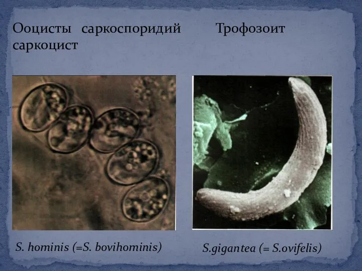 Ооцисты саркоспоридий Трофозоит саркоцист S. hominis (=S. bovihominis) S.gigantea (= S.ovifelis)