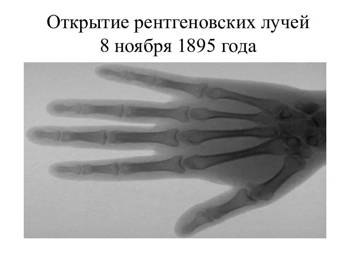 Открытие рентгеновских лучей 8 ноября 1895 года