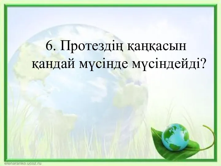 6. Протездің қаңқасын қандай мүсінде мүсіндейді?