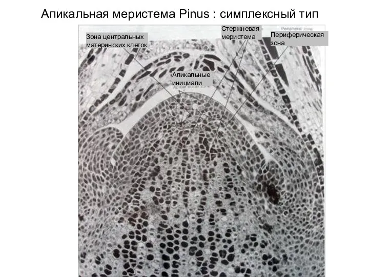 Апикальная меристема Pinus : симплексный тип Апикальные инициали Зона центральных материнских клеток Периферическая зона Стержневая меристема