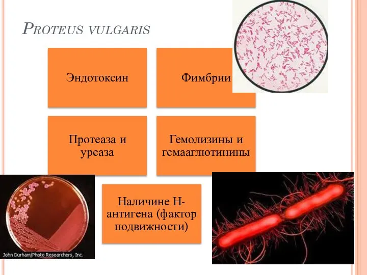 Proteus vulgaris Эндотоксин Фимбрии Протеаза и уреаза Гемолизины и гемааглютинины Наличине Н-антигена (фактор подвижности)