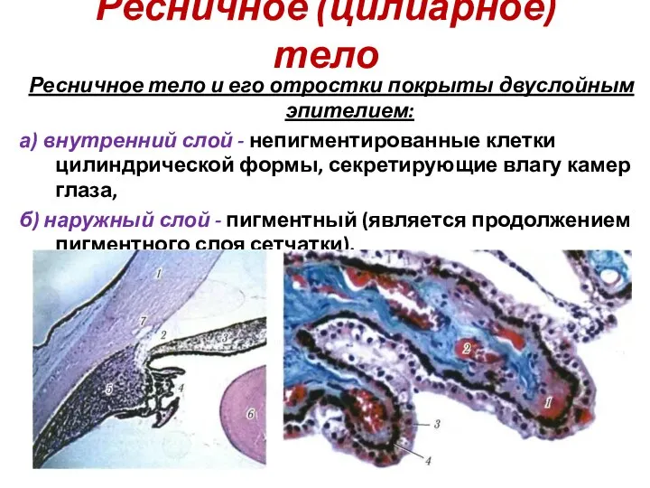 Ресничное (цилиарное) тело Ресничное тело и его отростки покрыты двуслойным эпителием: а)