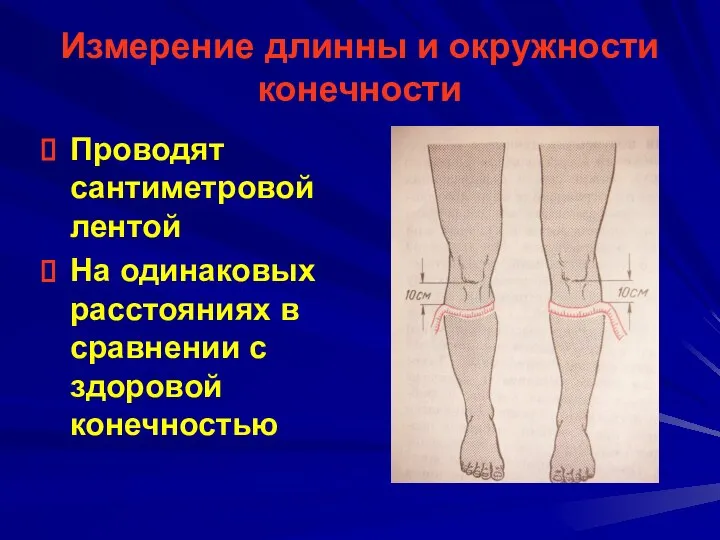 Измерение длинны и окружности конечности Проводят сантиметровой лентой На одинаковых расстояниях в сравнении с здоровой конечностью