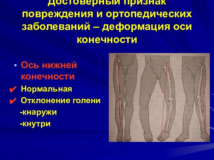 Достоверный признак повреждения и ортопедических заболеваний – деформация оси конечности Ось нижней