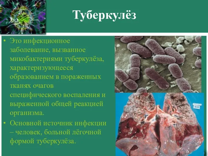 Туберкулёз Это инфекционное заболевание, вызванное микобактериями туберкулёза, характеризующееся образованием в пораженных тканях
