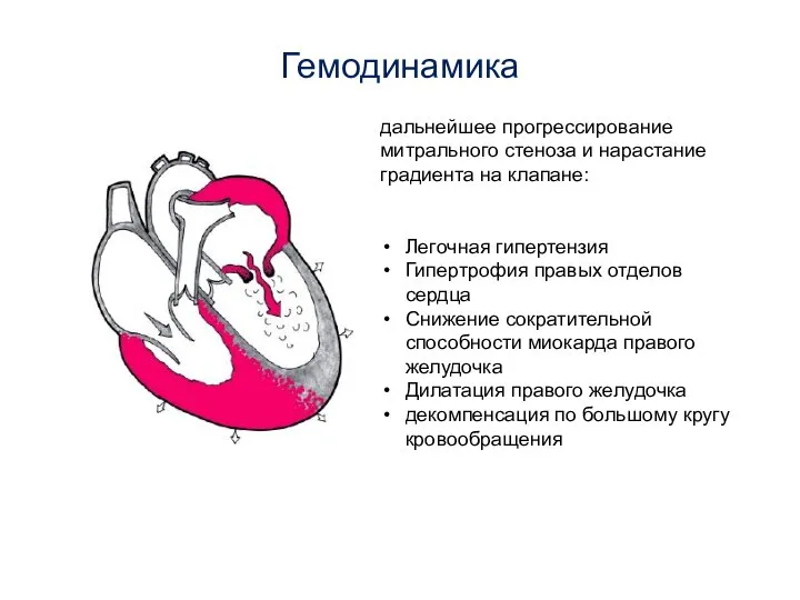 Гемодинамика дальнейшее прогрессирование митрального стеноза и нарастание градиента на клапане: Легочная гипертензия