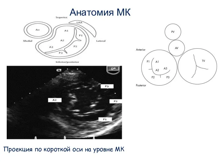 Проекция по короткой оси на уровне МК Анатомия МК