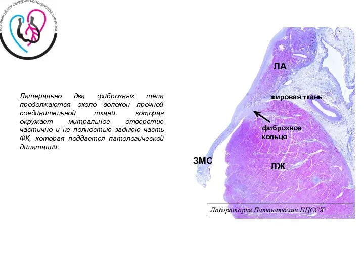 Лаборатория Патанатомии НЦССХ Латерально два фиброзных тела продолжаются около волокон прочной соединительной