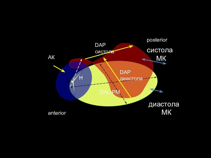 posterior anterior АК H DAP систола DAP диастола DAL-PM систола МК диастола МК