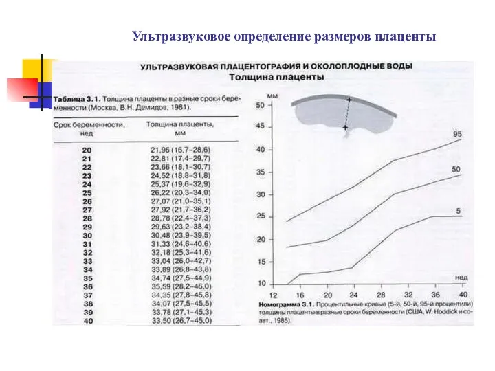 Ультразвуковое определение размеров плаценты