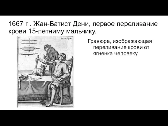 1667 г . Жан-Батист Дени, первое переливание крови 15-летниму мальчику. Гравюра, изображающая