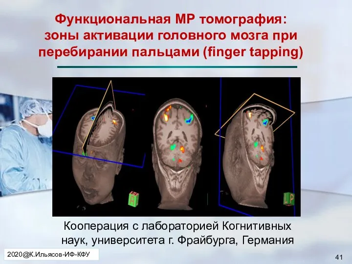 Кооперация с лабораторией Когнитивных наук, университета г. Фрайбурга, Германия Функциональная МР томография: