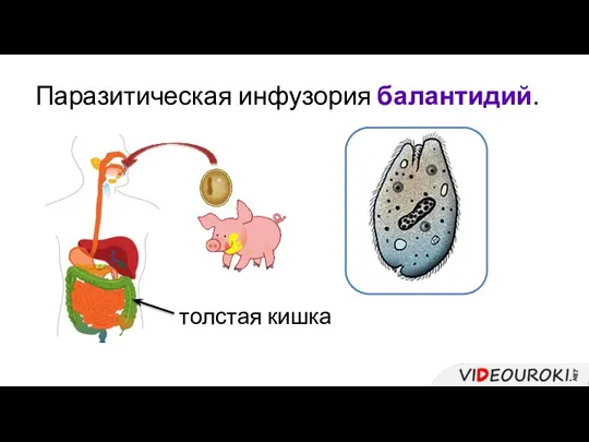 Паразитическая инфузория балантидий. толстая кишка