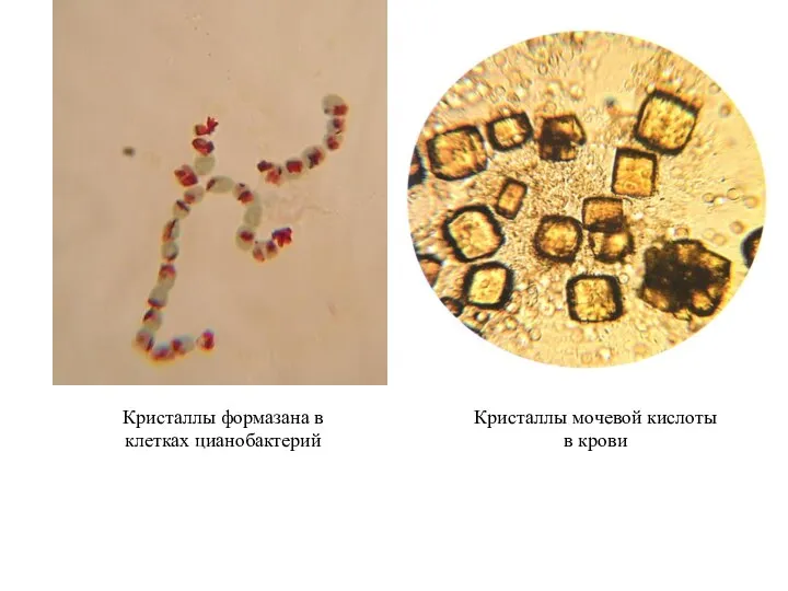Кристаллы формазана в клетках цианобактерий Кристаллы мочевой кислоты в крови