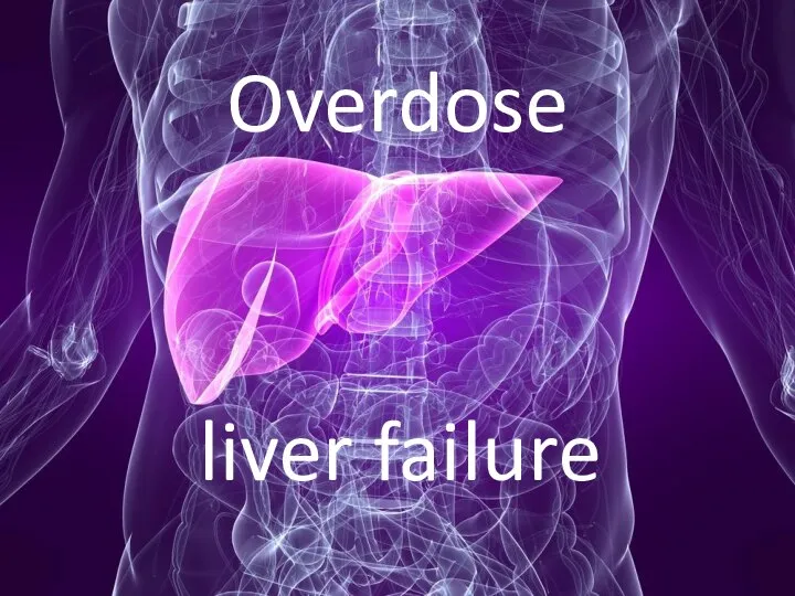 Overdose liver failure