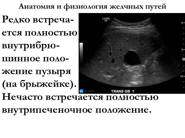 Анатомия и физиология желчных путей Редко встреча- ется полностью внутрибрю- шинное поло-