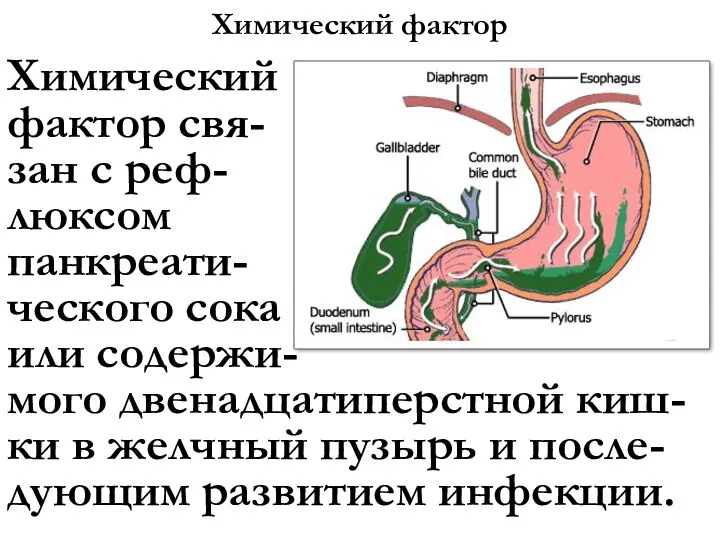 Химический фактор Химический фактор свя- зан с реф- люксом панкреати- ческого сока