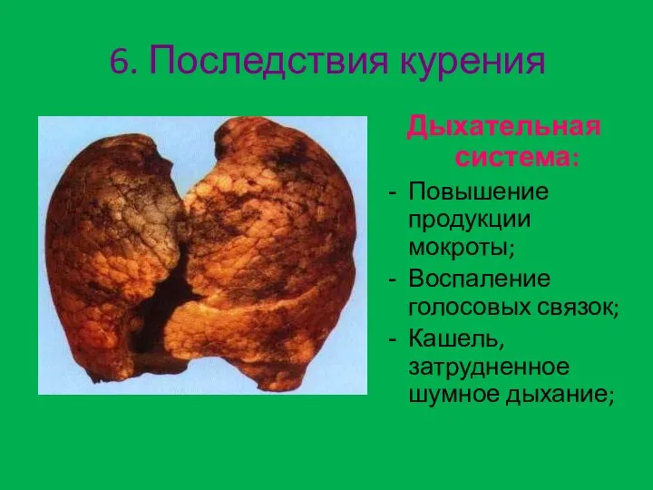 6. Последствия курения Дыхательная система: Повышение продукции мокроты; Воспаление голосовых связок; Кашель, затрудненное шумное дыхание;