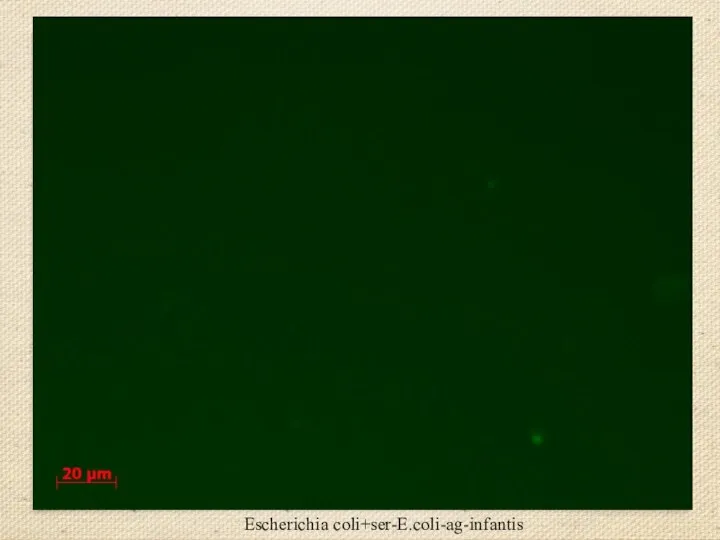 Escherichia coli+ser-E.coli-ag-infantis