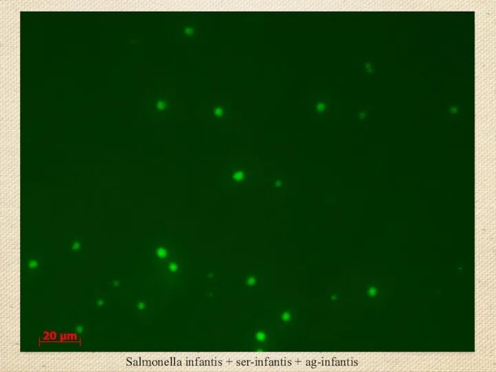 Salmonella infantis + ser-infantis + ag-infantis