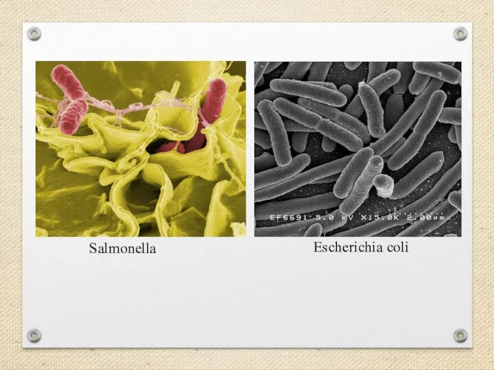 Salmonella Escherichia coli