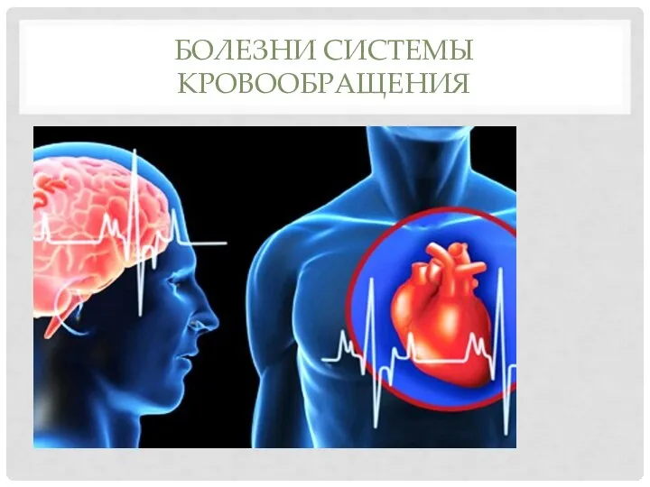 БОЛЕЗНИ СИСТЕМЫ КРОВООБРАЩЕНИЯ