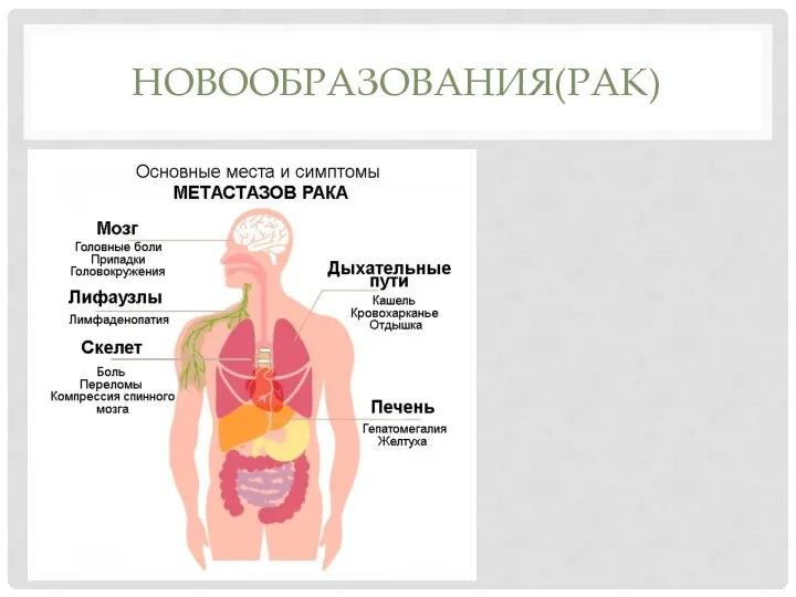 НОВООБРАЗОВАНИЯ(РАК)