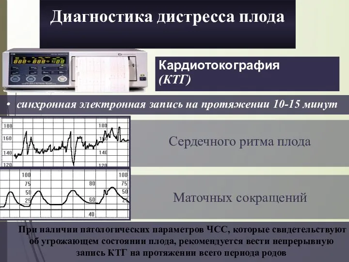 Кардиотокография (КТГ) Сердечного ритма плода Маточных сокращений синхронная электронная запись на протяжении