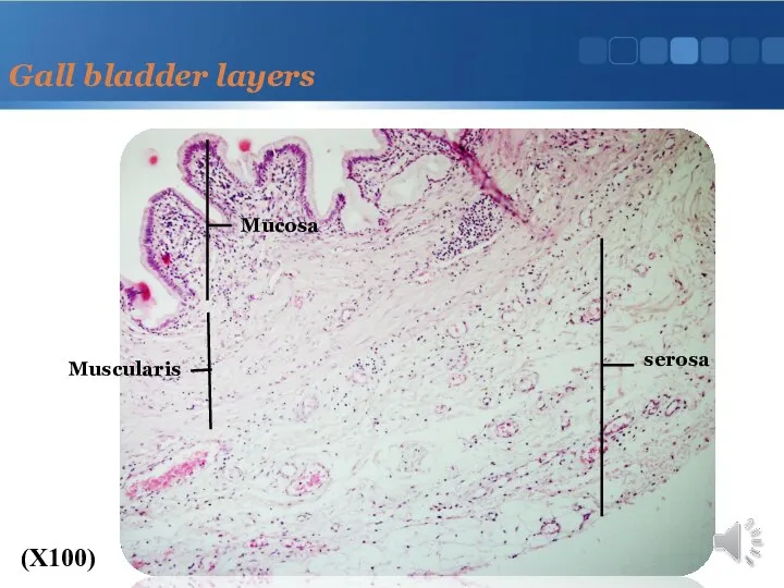 Gall bladder layers (X100) Mucosa Muscularis serosa