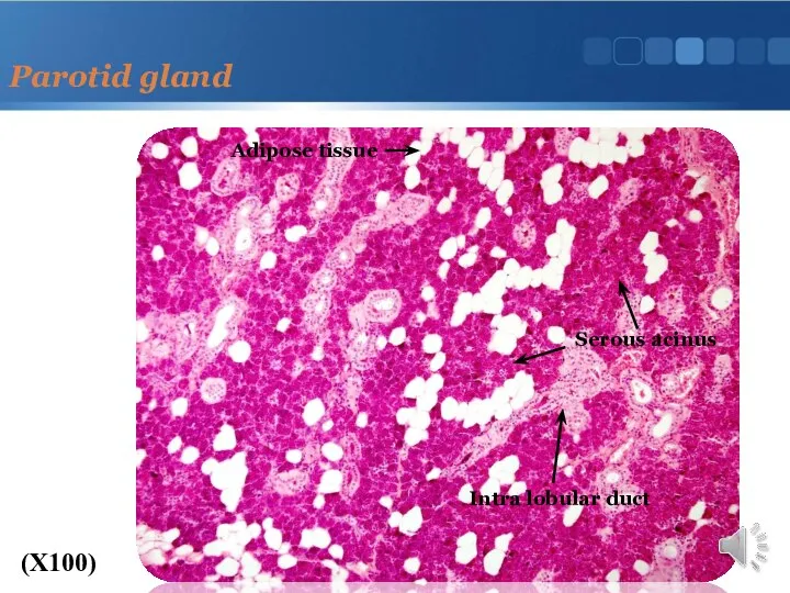 Parotid gland (X100) Adipose tissue Intra lobular duct Serous acinus
