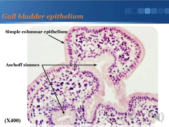 Gall bladder epithelium (X400) Simple columnar epithelium Aschoff sinuses
