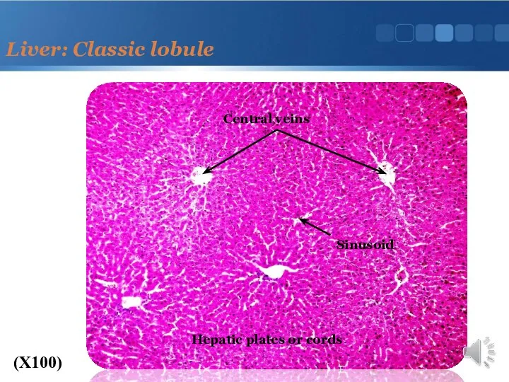 Liver: Classic lobule (X100) Central veins Hepatic plates or cords Sinusoid