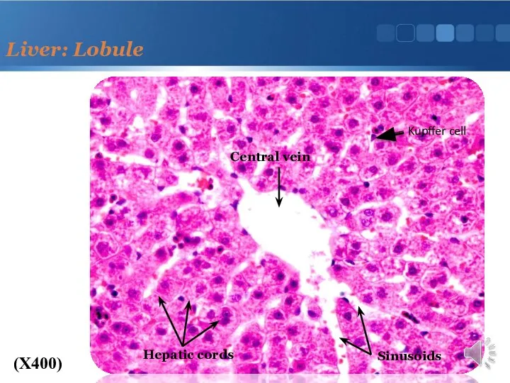 Liver: Lobule (X400) Central vein Hepatic cords Sinusoids Kupffer cell