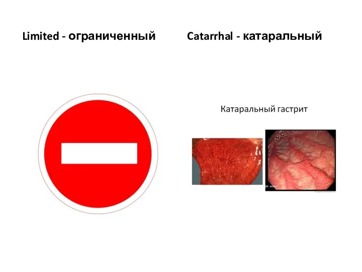 Limited - ограниченный Catarrhal - катаральный