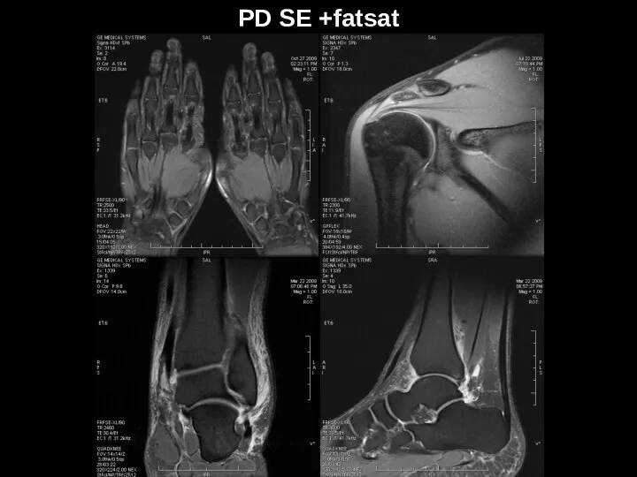 PD SE +fatsat