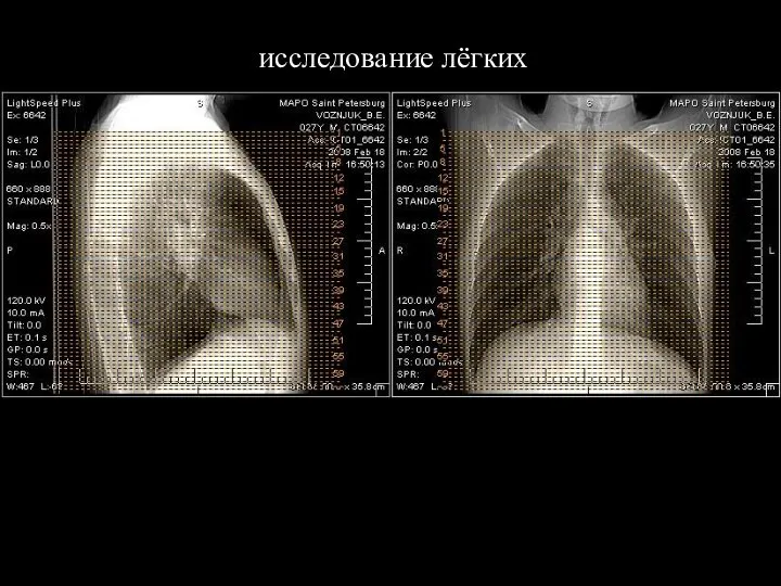 исследование лёгких