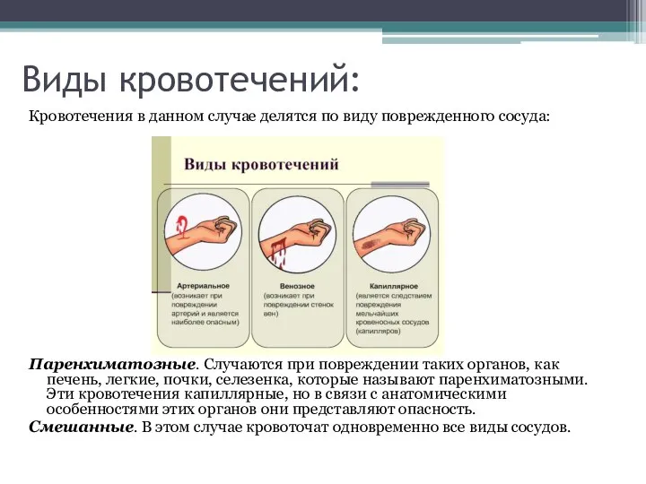 Виды кровотечений: Кровотечения в данном случае делятся по виду поврежденного сосуда: Паренхиматозные.