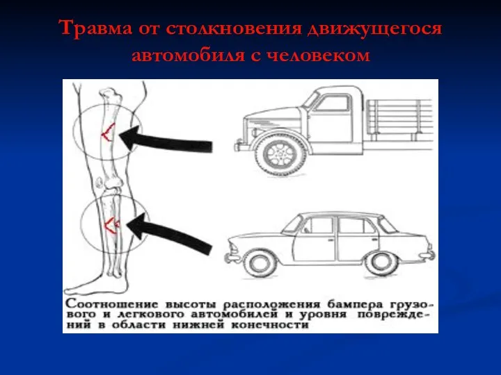 Травма от столкновения движущегося автомобиля с человеком