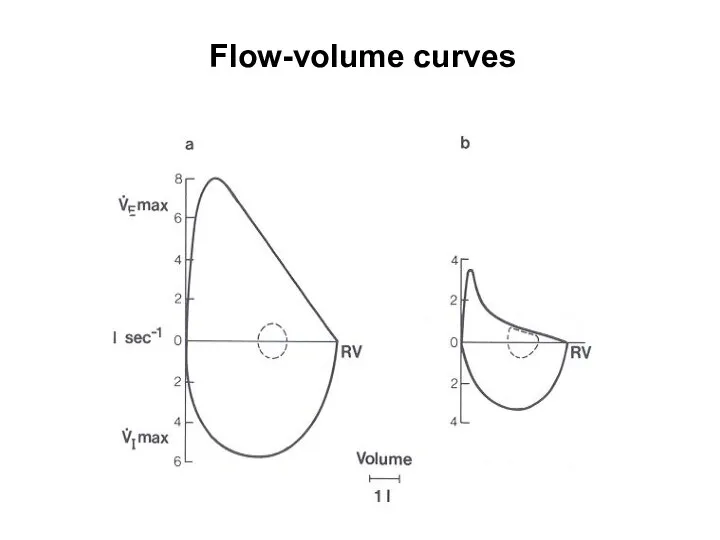 Flow-volume curves