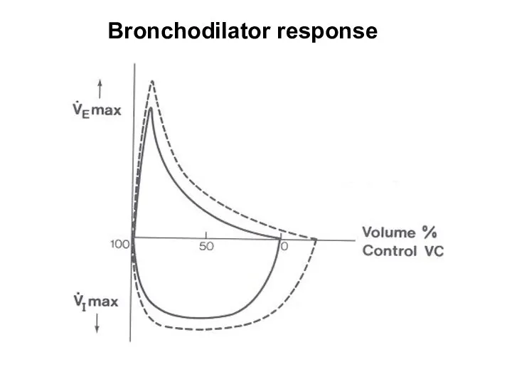 Bronchodilator response