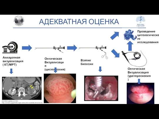 АДЕКВАТНАЯ ОЦЕНКА Аппаратная визуализация ( КТ/МРТ) Оптическая Визуализация (цистоскопия) Взятие биопсии Проведение