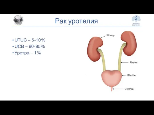 Рак уротелия UTUC – 5-10% UCB – 90-95% Уретра – 1%