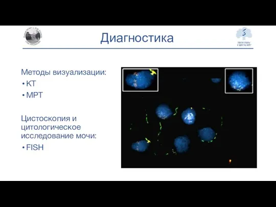 Диагностика Методы визуализации: КТ МРТ Цистоскопия и цитологическое исследование мочи: FISH