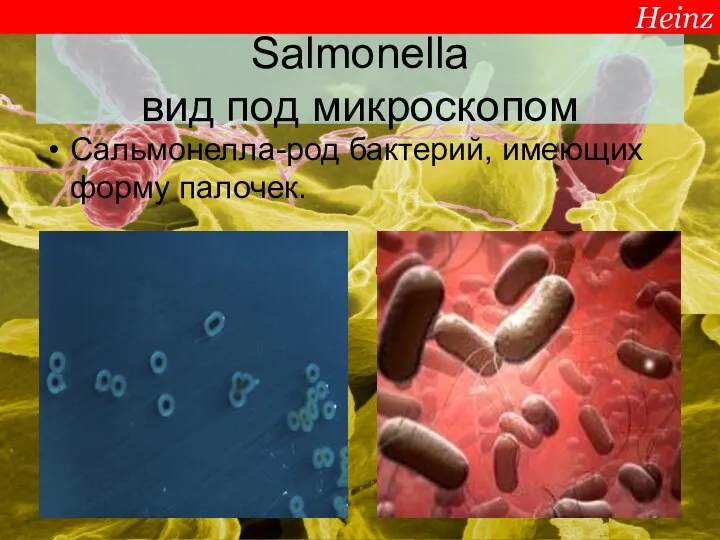 Salmonella вид под микроскопом Сальмонелла-род бактерий, имеющих форму палочек. Heinz